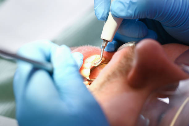 Best Emergency Orthodontic Services in Bethesda, MD